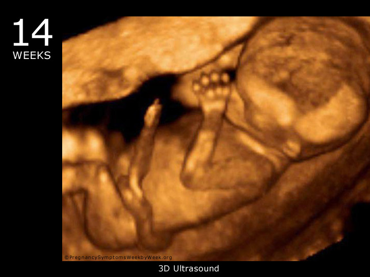 14.hafta-gebelik-ultrason