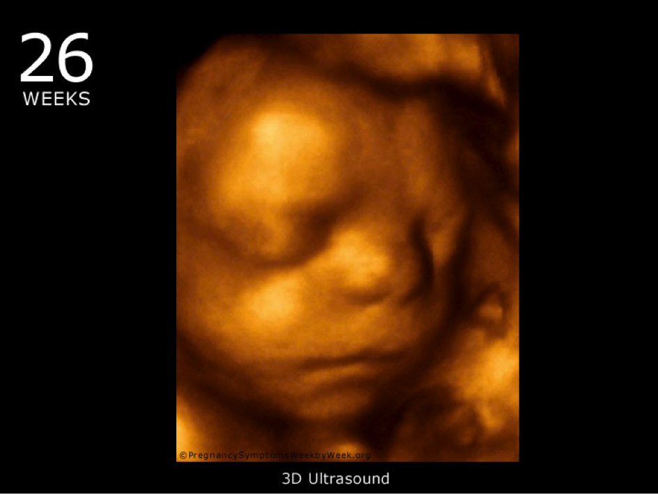 26.-hafta-gebelik-ultrason.