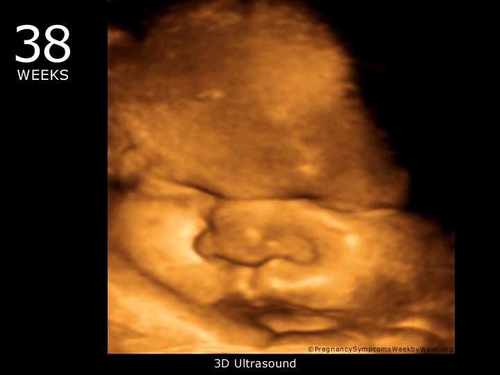 38.-hafta-gebelik-ultrason
