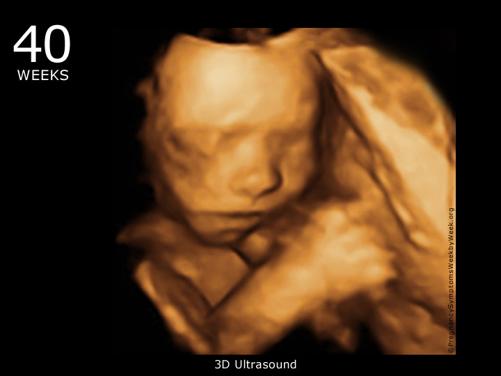 40.haftada-bebegin-ultrason